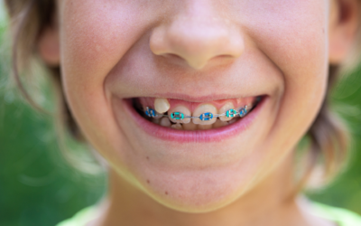 Inspiring the Best in Our Youngest Patients: Early Orthodontic Treatment