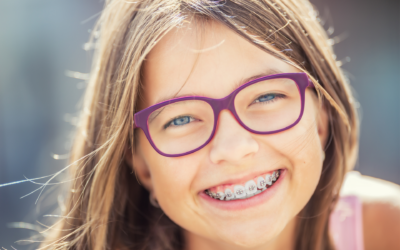 Ready, Set, Adventure! Three Tips to Gear Up for Your New Braces at Inspire Orthodontics
